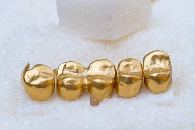 la composition de l'or dentaire